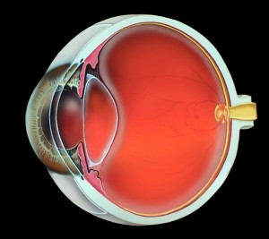 Eye which does not need cataract surgery